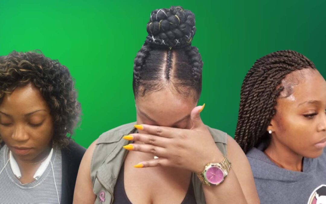 The Ultimate Guide to Knotless Braids: Why They’re a Game-Changer for Protective Styles